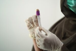 ニキビの原因を血液検査で特定する方法は？