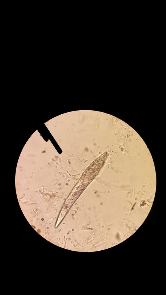 ニキビの内側に潜む原因を見つけるためのチェックリストは？