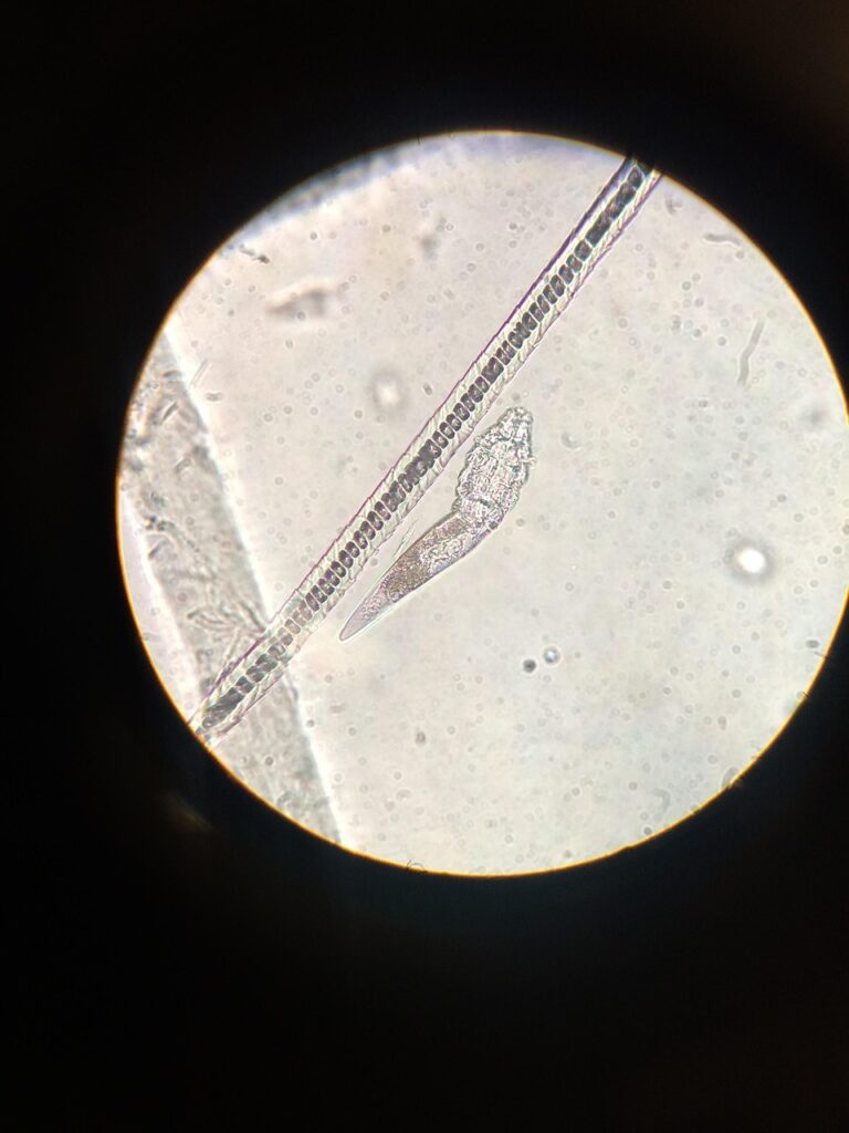 フェイスラインのニキビを繰り返す原因と食生活の見直し方法は？