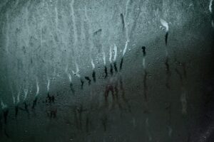 繰り返すニキビの改善における水分摂取で冷たい水と常温の違いは？