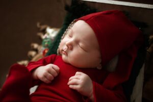 繰り返すニキビの睡眠リズムを整える方法は？